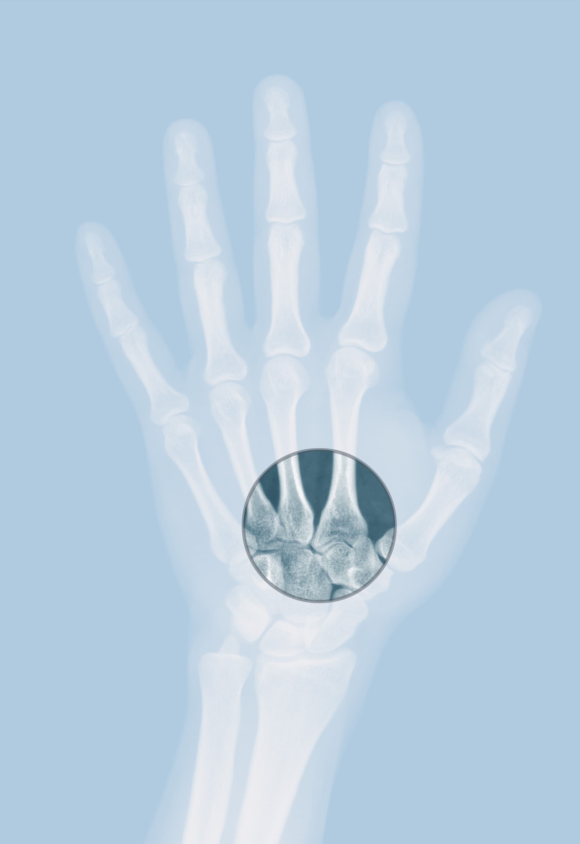 Radiological scan reviewed by a specialist